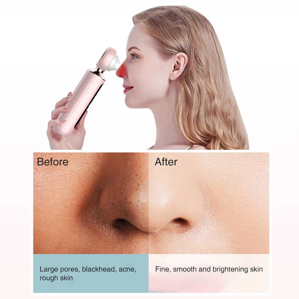 Blossom & bliss™ Blackhead Suction Machine