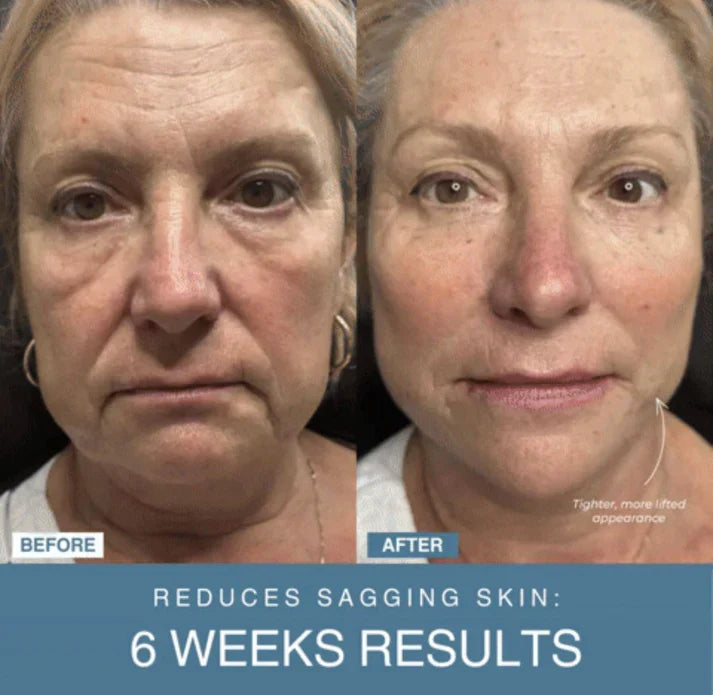 Blossom & bliss™ 7-in-1 LED Anti-Aging/Wrinkle Apparatus